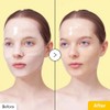 Eqqualberry Collagen Glow Up Hydrogel Mask