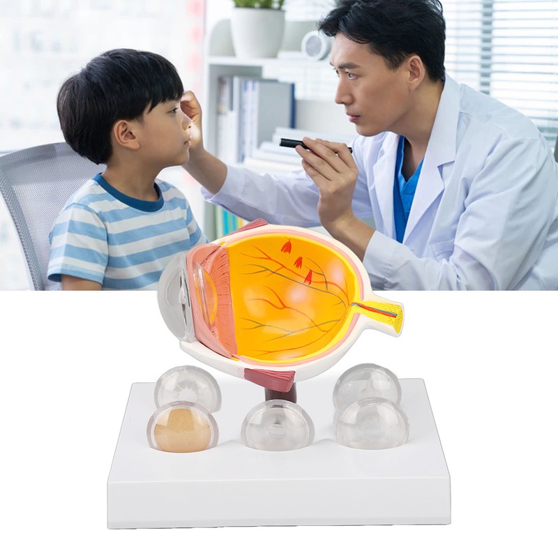 Enlarged Human Eye Anatomical Model Accurate Shows Optic Nerves Cornea