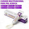 Ácido Azelaico 15% Suero Facial Hidratante – 20g Tuzkevla