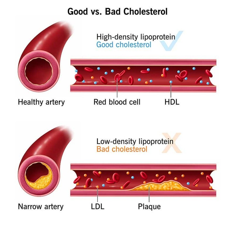 supplements4me CHOLESTEROL BAD REMOVER & FLUSHER ANTIOXIDANT SUPPLEMENT 90 PILL