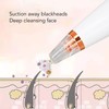 Vacuum Blackhead Machine with 6 Suction Heads 3 Levels Rechargeable