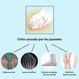 Correctores de Juanete, 2 PCS Férulas de Juanete de Talla Ajustable, Adapta a Todos Los Tamaños de Pie para el Alivio del Dolor de Los Juanetes y la Corrección del Valgo del Dedo del Pie, Azul