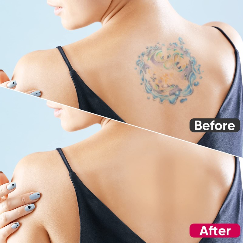 Tattoo Cover Up Patch, 6 PCS Ultra-Thin Breathable Design for