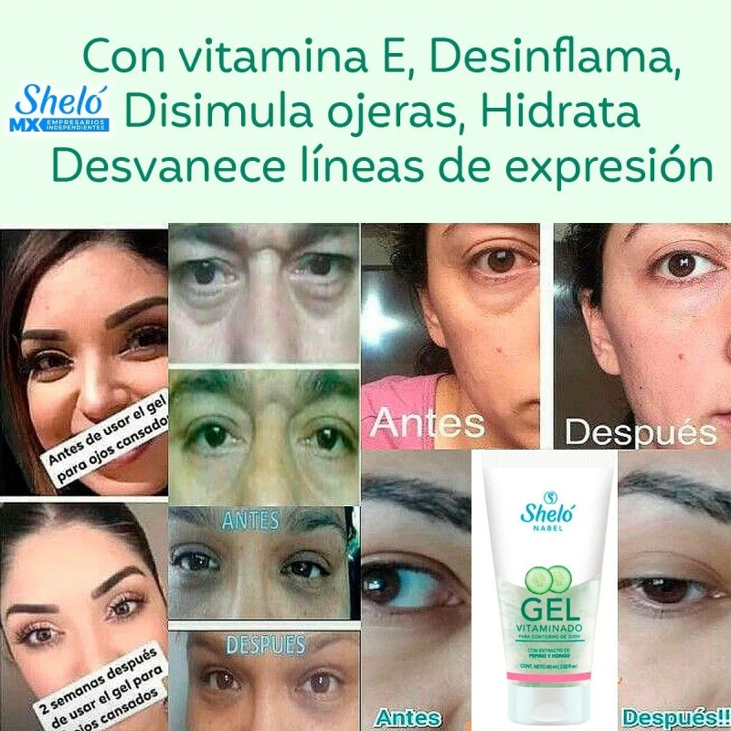 Tratamiento Quita Ojeras Oscuras E Hinchadas Natural 60 Ml Todo