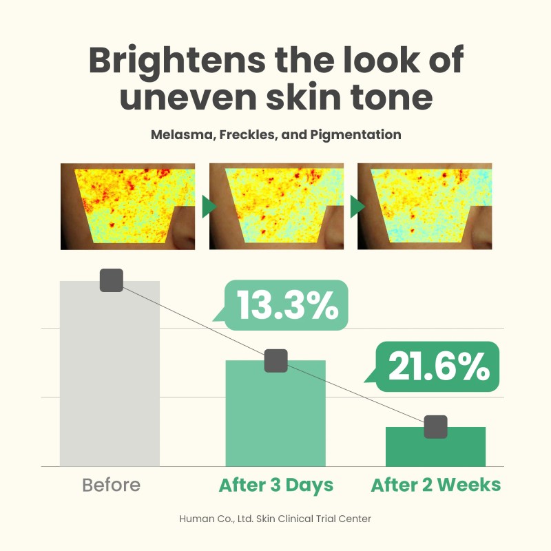 AXIS-Y [AXIS-Y]Glow Your Own Way Set