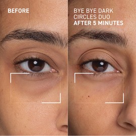 Dr. Brandt Bye Bye Dark Circles Duo - Includes No More Baggage (0.5 oz) & Bright This Way 24/7 Retinol Eye Cream (0.5 fl oz)