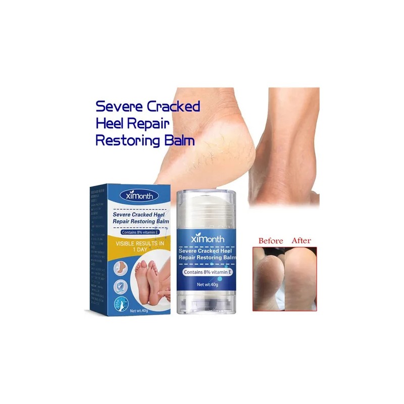 2×crema Reparadora Grietas Secas Y Talones For Pies Y Mano