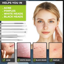 Dermated [6 Pcs] Blackhead Remover Tools Pimple Popper Tool Kit | Stainless Steel Professional Pimple Extractor Tool Kit for Blackheads, Blemish, Comdone, Acne, Zit, and Whiteheads for Face & Nose