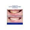 Pasta De Dientes Supersmile Professional Para Blanquear Los