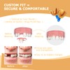 Partial Dentures - Dentures for Missing Teeth & Gaps -