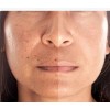 Serum Aclarante Facial Nicotinamida Arbutina Manchas Ojera30
