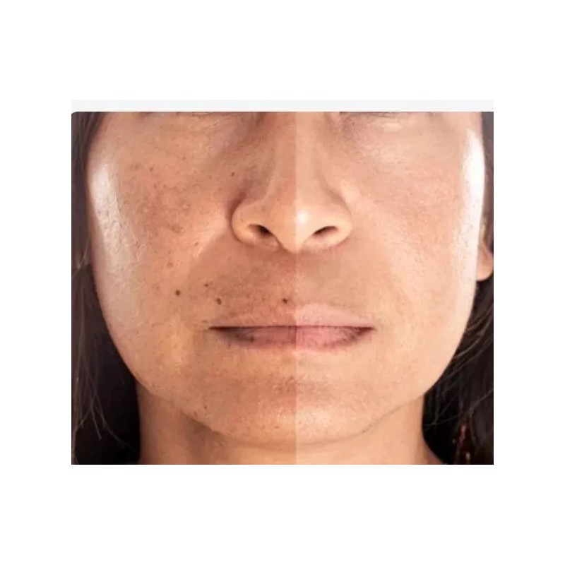 Serum Aclarante Facial Nicotinamida Arbutina Manchas Ojera30