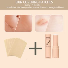 Scar Solutions Silicone Scar Stick with 60% Silicone, Manual Massage Applicator for Face and Body, Easy-to-Use Stick Design (2)