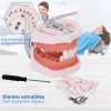 Tipodonto Dientes Articulado Tipo Nissiin Encía Suave