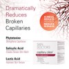 Skin Doctors Capillary Clear Cream, Broken Capillary Formula, 50 ml