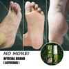 AIFUFAND Ginger Foot Spray - 7-Day Foot Care for Support