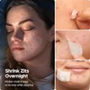 LitBear Hydrocolloid Acne Patches - 5 Sizes for Day &