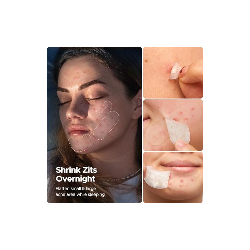 LitBear Hydrocolloid Acne Patches - 5 Sizes for Day &
