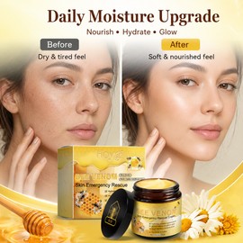 Bee Venom Moisturizing Cream for Face & Body – Nourishing Skin Care Balm for Daily Hydration