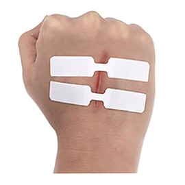 キズテープ キズに縫合 キズあとを縮む キズにケア介護 縫合代わり 家に常備 (45x10mm/10枚入, ホワイト)