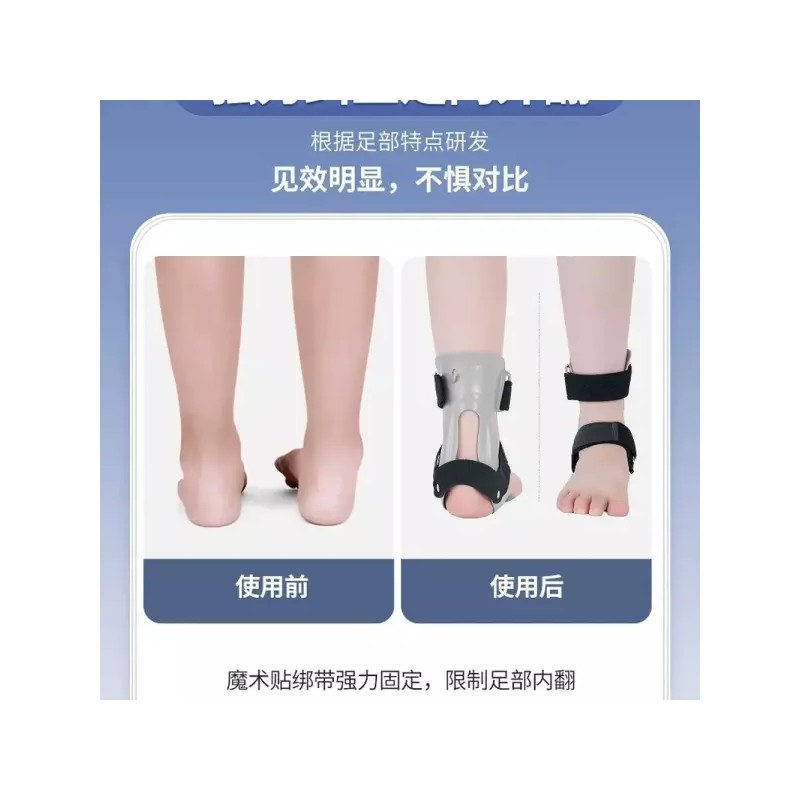 족하수 반장그레이 개 발목 풋 오른발국산 보행 [A. 왼발 국산