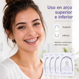 100 Piezas Arcos Niti, Archwire dental, Ortodontic Wires, Niti Super Elastic Archwire Ovoid Ortodoncia Dental, 10 Paquetes Lote Mixto