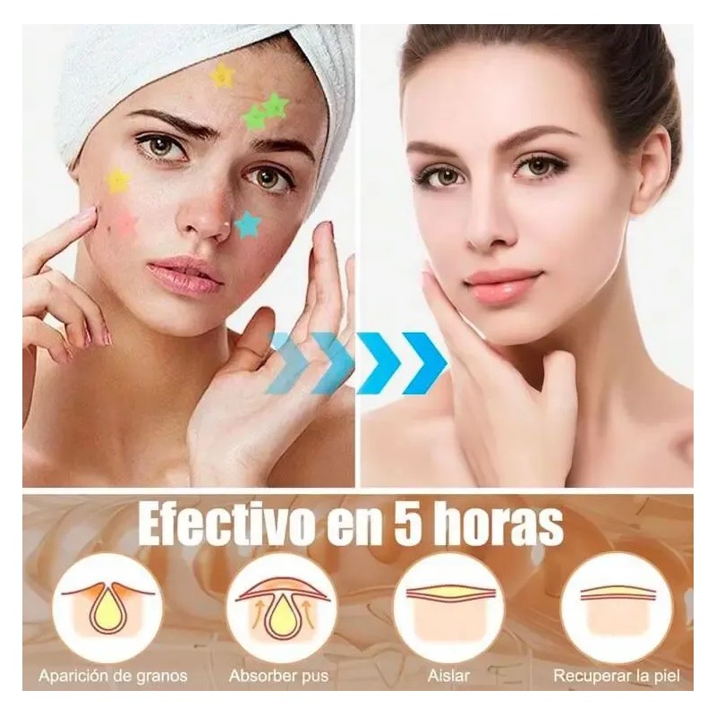 Pimple Patch - 240 Parches Anti Acné Waterproof Color Rosa