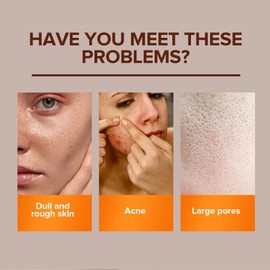 Turmeric Soap - Natural Kojic Acid Soap - Tumeric Soap Bar for Body & Face - Dark Spot Remover - Collagen Soap - Vitamin C Soap Bar for Even Skin Tone, Acne, Dark Spots, Smooth Skin