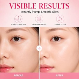 PDRN - Bálsamo múltiple de colágeno rosa, bálsamo facial y corporal K-Beauty para debajo de los ojos, cuello, frente, líneas sonrientes y labios, barr