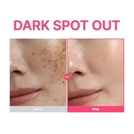PURITO TXA 6% + Niacinamide 10% + Retinal Facial Serum | for Dark Spots, Hyperpigmentation, Uneven Tone | High-Level Tranexamic Acid 6% | Korean skincare, 30mL 1.01 fl.oz