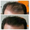 2 Volosy Original Fibras Capilares Disimular Calvicie 28g