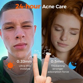 TKTK Bulk Pimple Patches for Face, 723 Patches 4 Size Acne Patches Day and Night, Hydrocolloid Patch Thin & Thick Pimple Stickers for Covering Zits, Blemishes and Breakouts