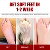 5 Pieces Exfoliating Foot Peel Mask Hydrating Moisturizing Smoothing for