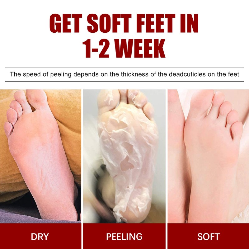 5 Pieces Exfoliating Foot Peel Mask Hydrating Moisturizing Smoothing for