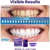 28 Piezas Tiras Blanqueadoras Dientes, Kit Blanqueador Dental Eficaz, Teeth
