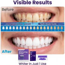 28 Piezas Tiras Blanqueadoras Dientes, Kit Blanqueador Dental Eficaz, Teeth Whitening Strips Para Dientes Más Blancos Manchas De Cafe Te O Vino, Facil Aplicacion, Para Cuidado Diario En Casa