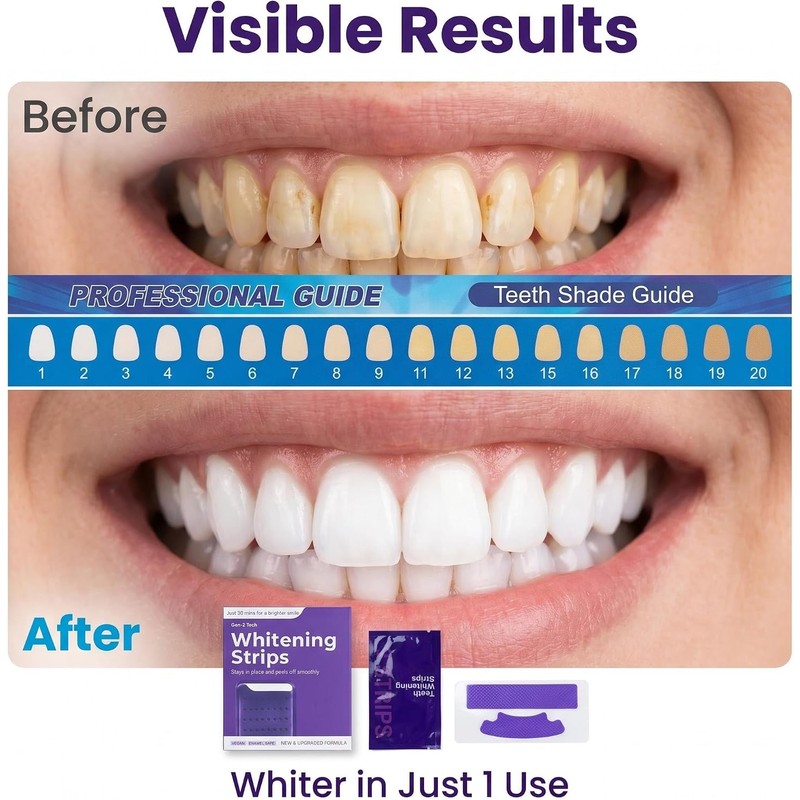 28 Piezas Tiras Blanqueadoras Dientes, Kit Blanqueador Dental Eficaz, Teeth