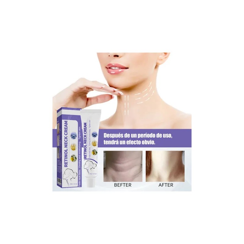 Mopoyat Crema Hidratante De Cuello Con Retinol Para Lneas Y