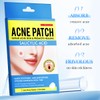 Anifer 36 Pcs Salicylic Acid Acne Patch - Hides Facial