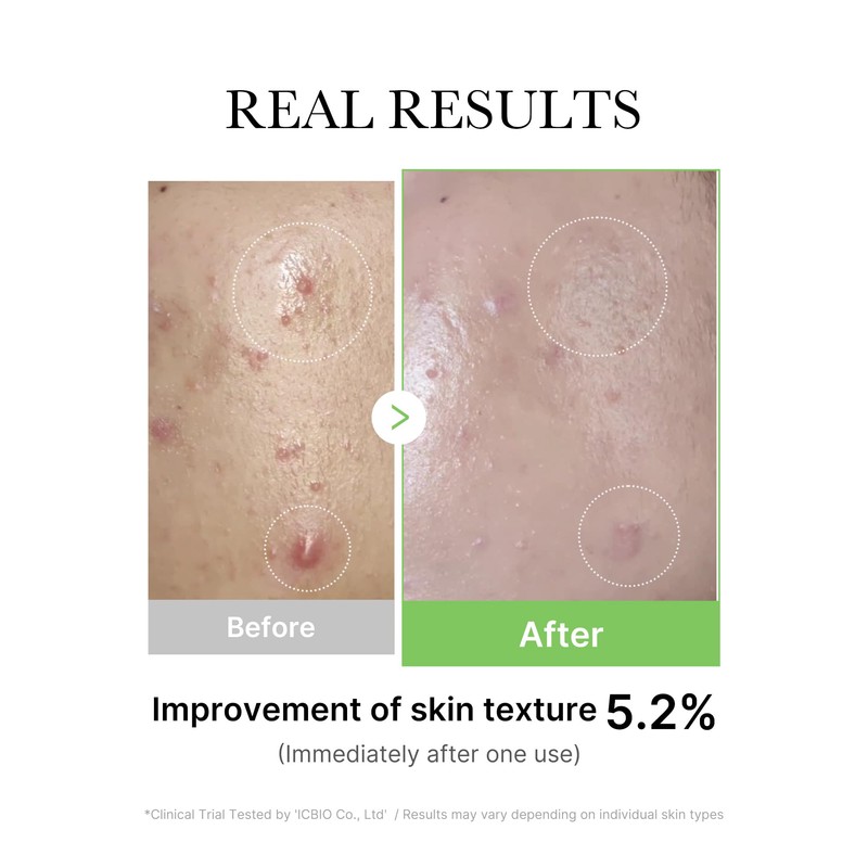 Medicube Exosome Cica Tea Tree Ampoule for Sensitive Skin with