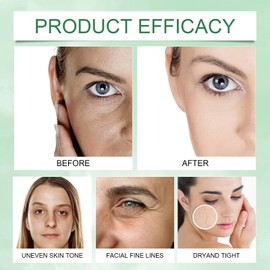 QiFind Grass Fed Beef Tallow with Frankincense Oil and Castor Oil, Organic Grass Fed Beef Tallow Moisturizer for Skin, Whipped Beef Tallow Manuka Honey Balm for Face Moisturizer Body, 2 PCS