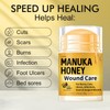 Manuka Honey for Wounds, Speed up Healing for Cuts, Surgical