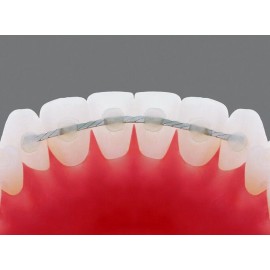 SCI 8-Strand Flat Lingual Retainer Wire - 010"x028" 60 inch spool SS