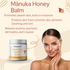 Manuka Honey Skin Soothing Balm for Dry, Itchy Skin
