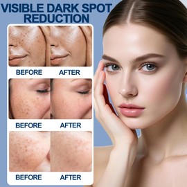 Dark Spot Remover for Face & Body, Dark Spot Corrector Cream with Collagen & Vitamin E, Hyperpigmentation Treatment for Even Skin Tone, Fades Sun Spots, Freckles & Blemishes, Gentle Moisturiser, 50ml