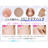 HQ Clear Pack, Hydroquinone Cream, Night Care, Peel Off Pack,