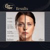 CureTape Beauty Kinesiology Tape | Anti-Wrinkle Face Tape | Face