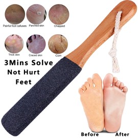 Pumic Stones for Feet Lava Pumice Stone Foot File Pumice Stone for Callus Removal Scrubber for Hands Care Foot Exfoliation Dead Skin Remover