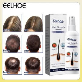 Growth Spray 50ml  Growth Serum Fast Scalp Treatments Anti  Loss Haircare Repair Hair