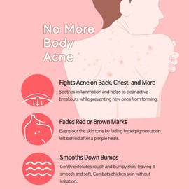 TIA'M TIAM Anti-Blemish Body Lotion, Body Acne Treatment, bacne, Great for fighting breakouts and acne scars removal, 6.76 FL.OZ.